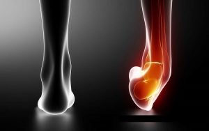 ảnh Bìa Chan Thuong Khop Co Chan